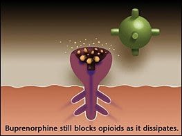 Over time (24-72 hours) buprenorphine dissipates, – but still creates a limited opioid effect (enough to prevent withdrawal) and continues to block other opioids from attaching to the opioid receptors.